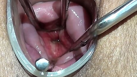 Maya Simons OPENING HER CERVIX (EXTREME)